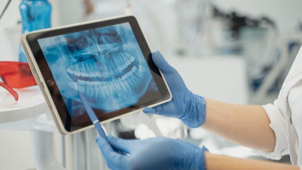 Ortodontista usando um scanner intraoral em forma de caneta na boca de uma paciente, com o modelo 3D numa tela ao lado.